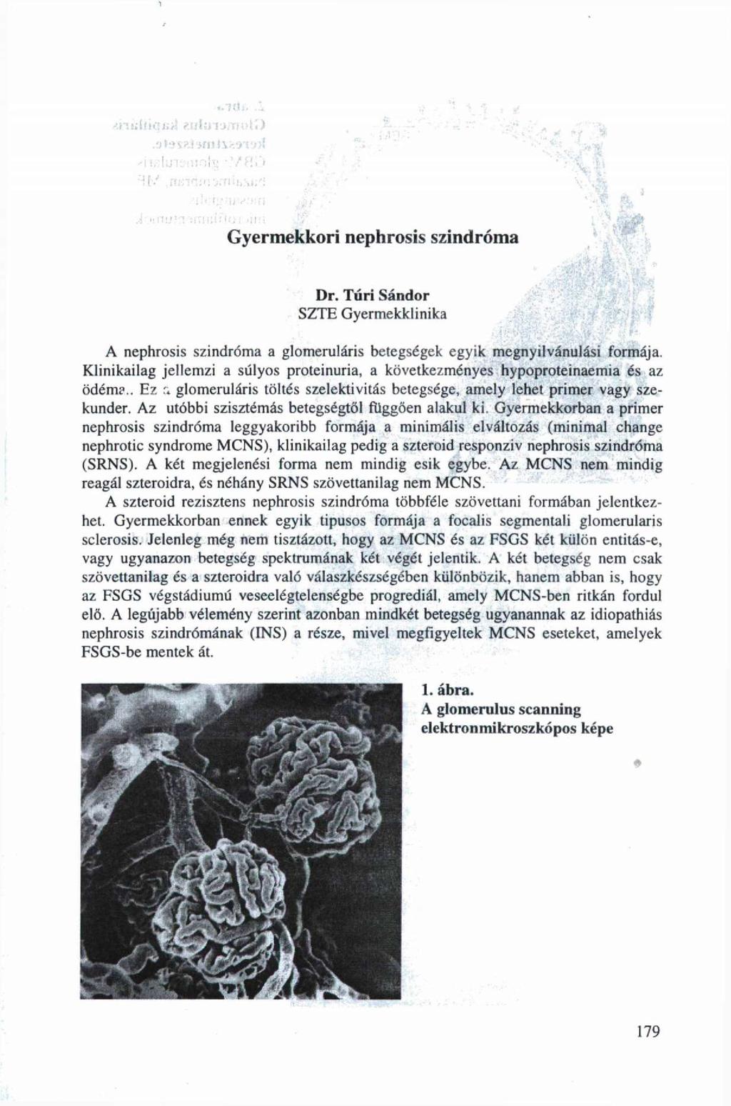 Kii. Hit Gyermekkori nephrosis szindróma Dr. Túri Sándor SZTE Gyermekklinika A nephrosis szindróma a glomeruláris betegségek egyik megnyilvánulási formája.