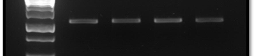 (M). Figure 3: Verification of the purification after the PCR was performed by gel electrophoresis Note: this figure shows the product of 4 samples after the purification, (M) means an 1 kb lenght