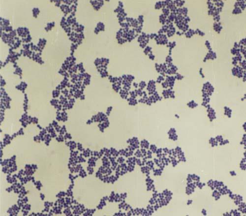 Streptococcaceae Micrococcaceae