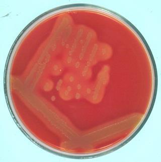 S. aureus