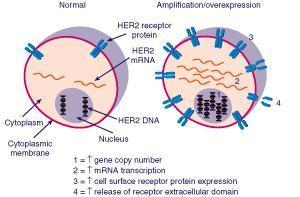overexpresszió Her2: