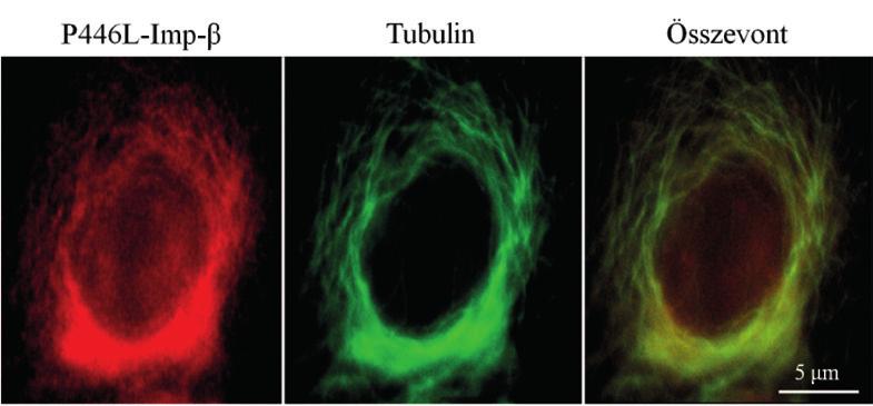 29. ábra. P446L-Imp-β és a mikrotubulusok olyan digitoninnal permeabilizált HeLa sejtben, amelyben minden feltétel adott volt a sejtmagi fehérje importhoz. (Amint a 28.