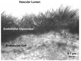Starlingtól a glycocalix elméletig c i } plasma proteins b A gycocalyx sérül: Ischemia-reperfusio Műtét, trauma Hyperglycaemia Gyulladásos mediátorok TNF-α, CRP, MCtriptáz Hypervolaemia!