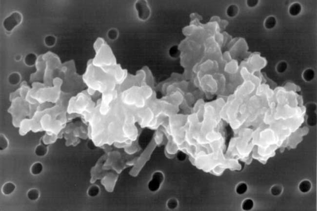 1mm. ábra. Egy kozmikus porszem mikroszkopikus képe. Megfigyelhetô a kondenzációk fokozatos összeállásával kialakult, összetett szerkezet (Science Daily, 8. szeptember.). szébôl származik.