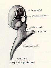 malleolarist hozza létre > dobüreg elülső falán fissura