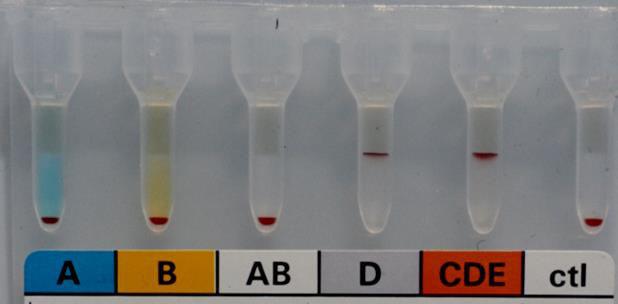 O - hiáyzó H PCR Csató E., Losoczy J., Friss A., Neuhauser J.