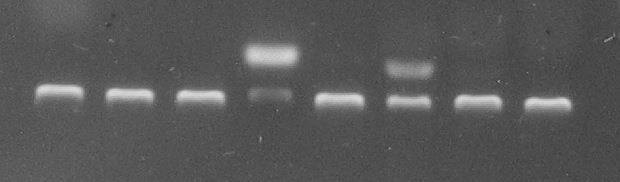 PCR- ZygoFast eredméy -  PCR-Dweak eredméy