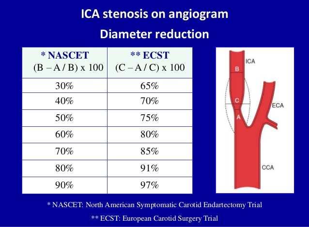 Following stroke or TIA, the degree of carotid artery stenosis should be reported using the North American Symptomatic Carotid