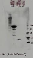 BL21/pGEX lizátum + 9 ml blokkoló puffer + 5 μl ellenanyag C: 5 ml BL21/pGEX lizátum + 5 ml blokkoló puffer + 5