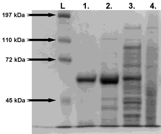 18. ábra. A TfBXyl43 enzim tisztítási lépéseinek SDS-PAGE analízise. Az egyes fehérje mintákat 8 %-os gélen futtattuk. L.: Fehérje Létra (BioRad, Prestained Broad Range SDS-PAGE Standard Cat.No.