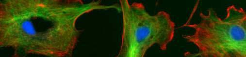 Mikroszkópia fluoreszcens jelöléssel Aktin