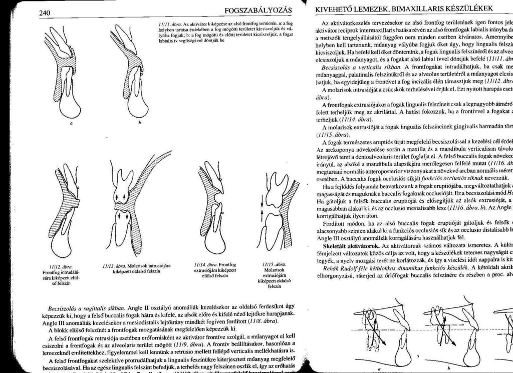 Extrakció nélkül normálokklúzió beállítása Bimaxilláris funkciós készülékek alkalmazása II.