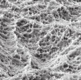 A három differenciált felület integrációja topográfiai szempontból az implantátum szerkezete és annak alkalmazási