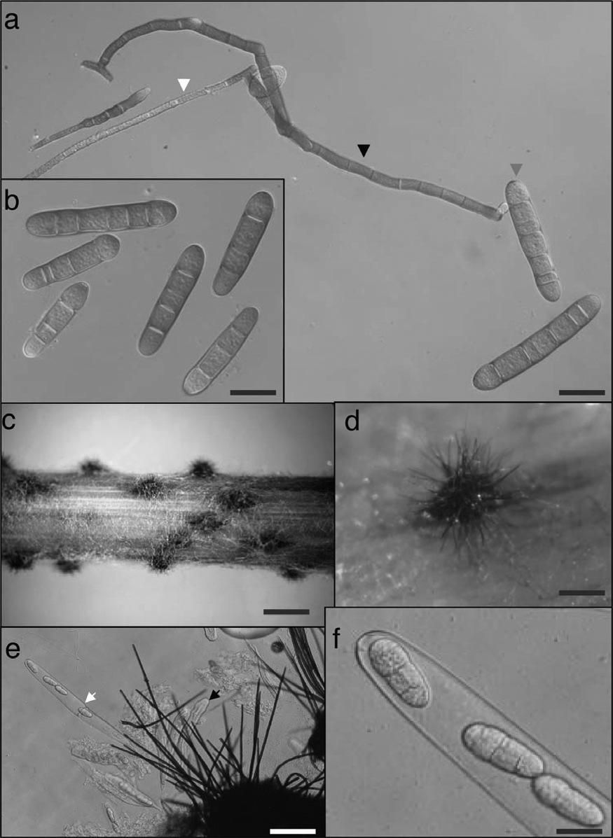 7. ábra A Pyrenophora teres f.