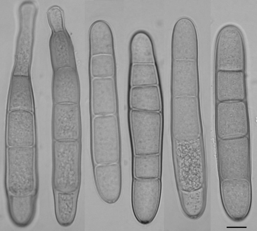 tünetekről származó ismeretlen Pyrenophora izolátumaink között jelentős méretbeli eltéréseket tapasztaltunk a konídiumok hossza (75,2 100,9 µm) és konídiumtartók hosszát (123,0 189,4 µm) illetően,