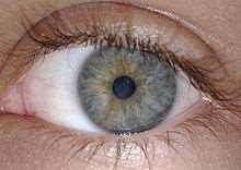 (mogyoró) kék heterochromia
