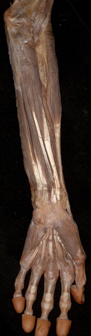 Gyengébb működés a könyökízületben (hajlító).