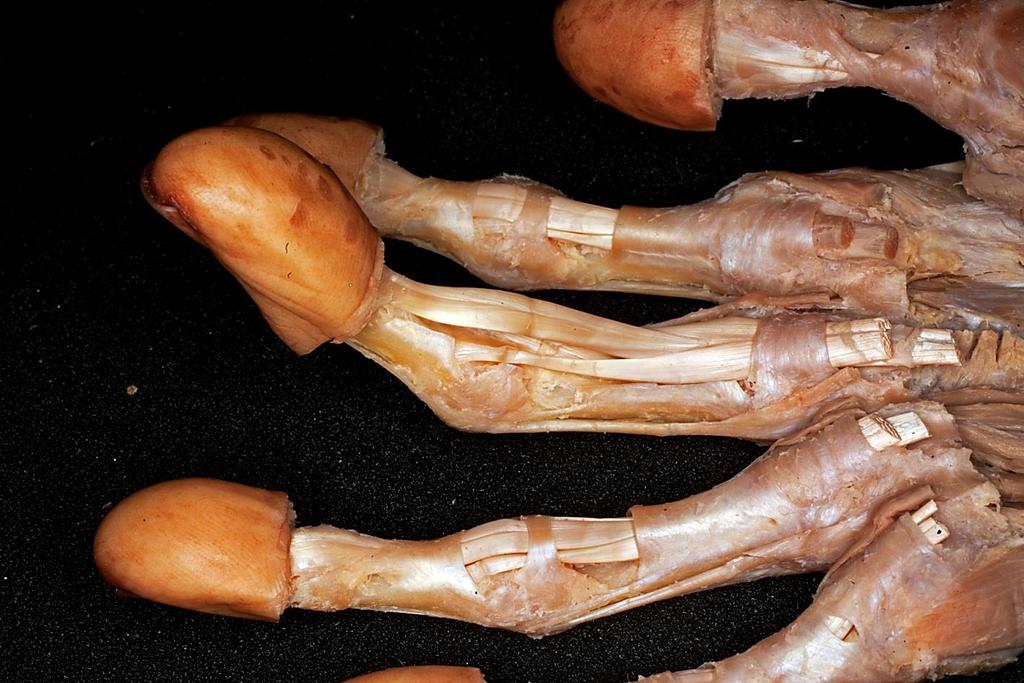 flexor. dig.