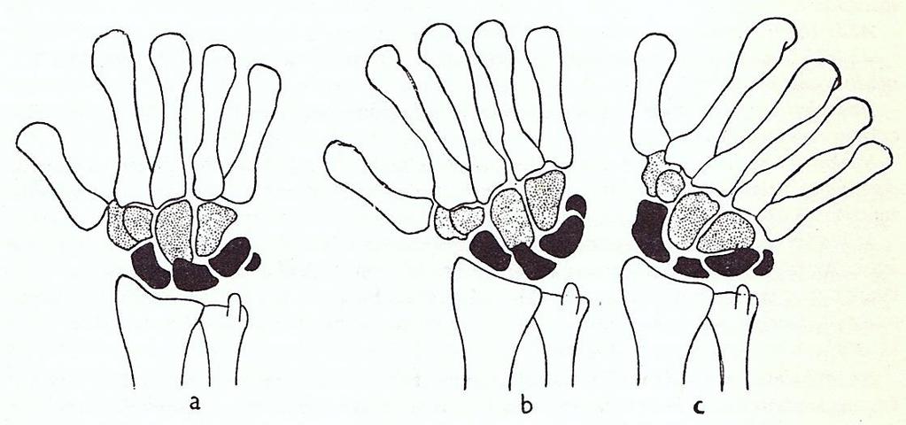 articulatio radiocarpera tengelye b.