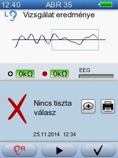 5 Vizsgálat az AccuScreen -el Vizsgálat eredménye: További vizsgálatra irányítva/nincs tiszta válasz Ha az eredmény További vizsgálatra irányítva/nincs tiszta válasz, a részletes eredmények