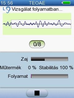 5 Vizsgálat az AccuScreen -el 5.2.2 A TEOAE vizsgálat A vizsgálat előrehaladását a kijelző mutatja. Ha szükséges, nyomja meg a Leállítás gombot a vizsgálat leállításához.