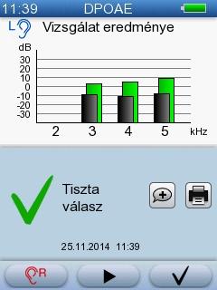 5 Vizsgálat az AccuScreen -el Vizsgálat időtartama - Normál DPOAE Normál hallású páciensek esetében kb.