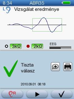 5 Vizsgálat az AccuScreen -el A vizsgálat részletei Folyamat Megmutatja a jelenlegi vizsgálati frekvencia eltelt idejét.