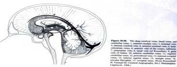 basalis ggl+ Thal) crticalis vv thrmbsis: PTC, látótér defektus (v. Labbé) cerebellaris vv.