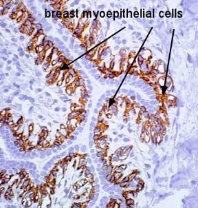 A mell elágazó mirigyjárat rendszere két típusú epithel sejtből épül fel: luminális epithel sejtek: belső réteg, polarizált sejtek, tejelválasztásért felelősek; myoepithel sejtek: