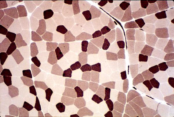 Mitokondriumok mennyiségét kimutató antitesttel készült festés: világos rostok az anaerob