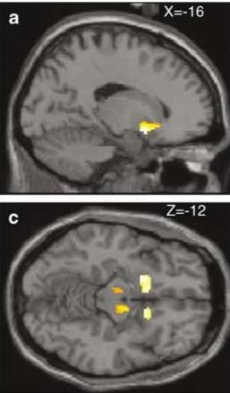 striatum/limbikus rendszer: tüzelés fokozása váratlan jutalomra/újdonságra/jelentős