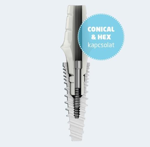 Denti implantációs rendszer A Fogászati és Szájsebészeti Oktató Intézet létrejötte, 2013 óta alkalmazza a Denti implantációs rendszert.