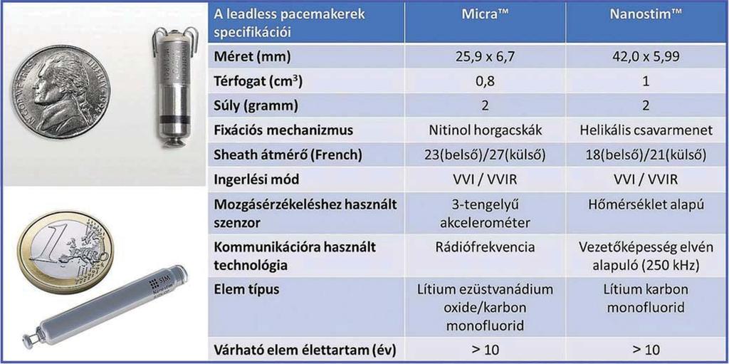 Bevezetés lis pacemaker-elektróda beültetése óta (1) a pacema- - pacemakerek beültetése kapcsán.