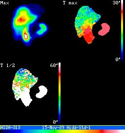 HIDAmozi.gif Máté: Orvosi képalkotás 133 Fázis és amplitúdó kép Az EKG kapuzott vizsgálat esetén minden pixel érték periodikusan változik, tehát Fourier sorba fejthető. Legyen F k a sorozat k.