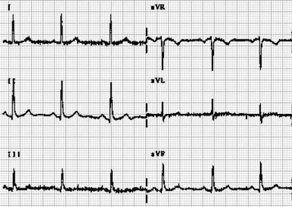 BEVEZETÉS Ebben a jegyzetben racionális ortogonális rendszerekkel foglalkozunk. Vizsgálatainkat az EKG görbék elemzése motiválta.