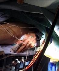 PRIMER MOTOROS KÉREG R R R STIMULÁCIÓ INDIKÁCIÓK NEUROPATHIÁS