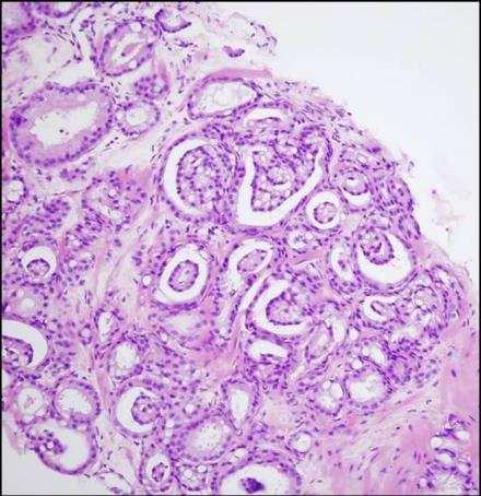 a - glomeruloid mirigyek