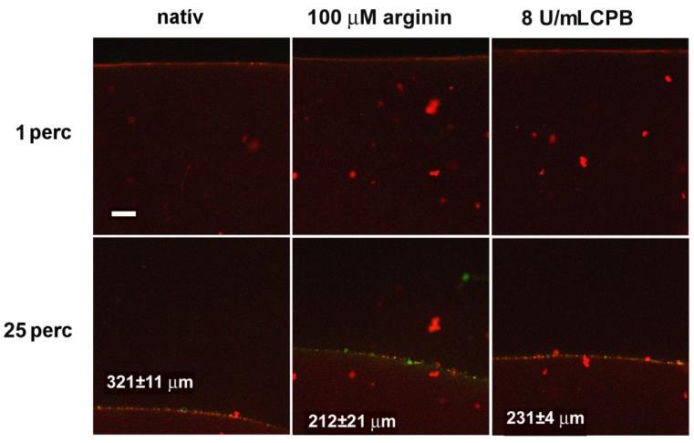 6. ábra: Arginin és CPB hatásai a tpa-yfp fibrin-penetrációjára a lysis folyamata során A lysis kinetikáját turbidimetriával követve, felszínről indított lysis során a CPB 8 U/mL koncentrációnál