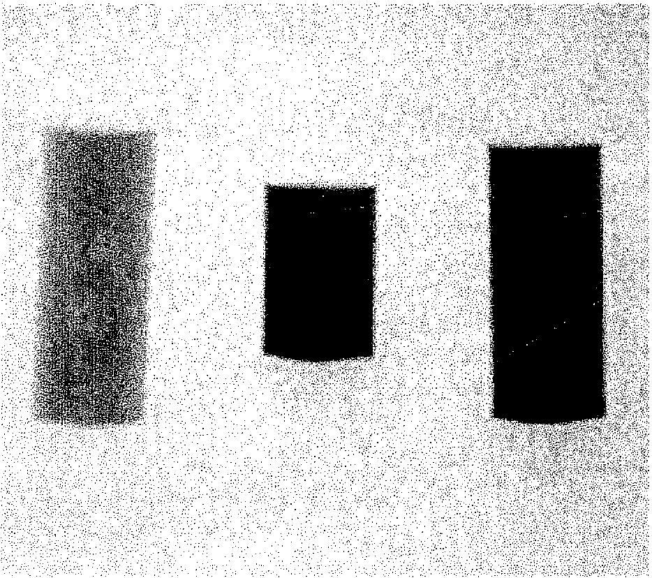 a beteg termete és a kezelni kívánt csigolya nagysága határozta meg. Neuro- navigáció során mindig 15 cm hosszú tűt alkalmaztunk.