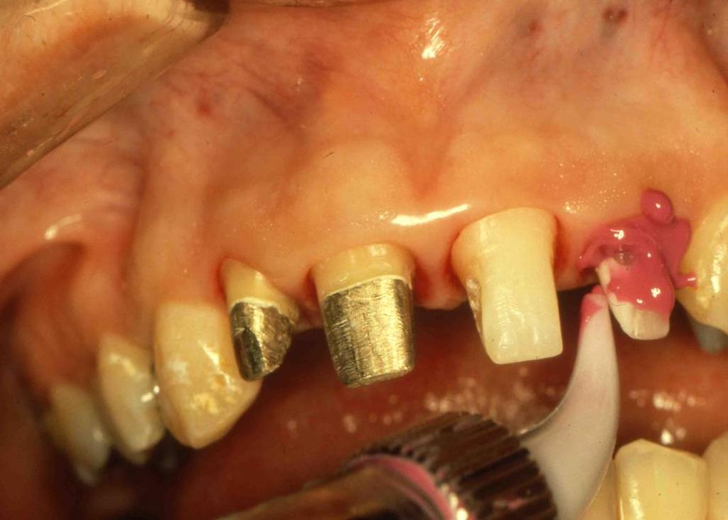 Dr. Herma