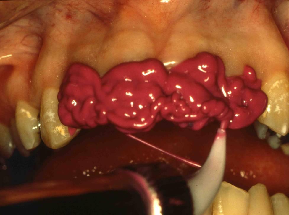 Dr. Herma