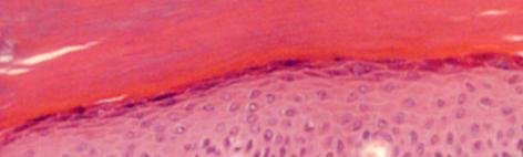 sejtmagmentes, homogénnek tűnő réteg eosinophil) 3 Stratum granulosum (2-3 sejtsor ellaposodó sejtekből,