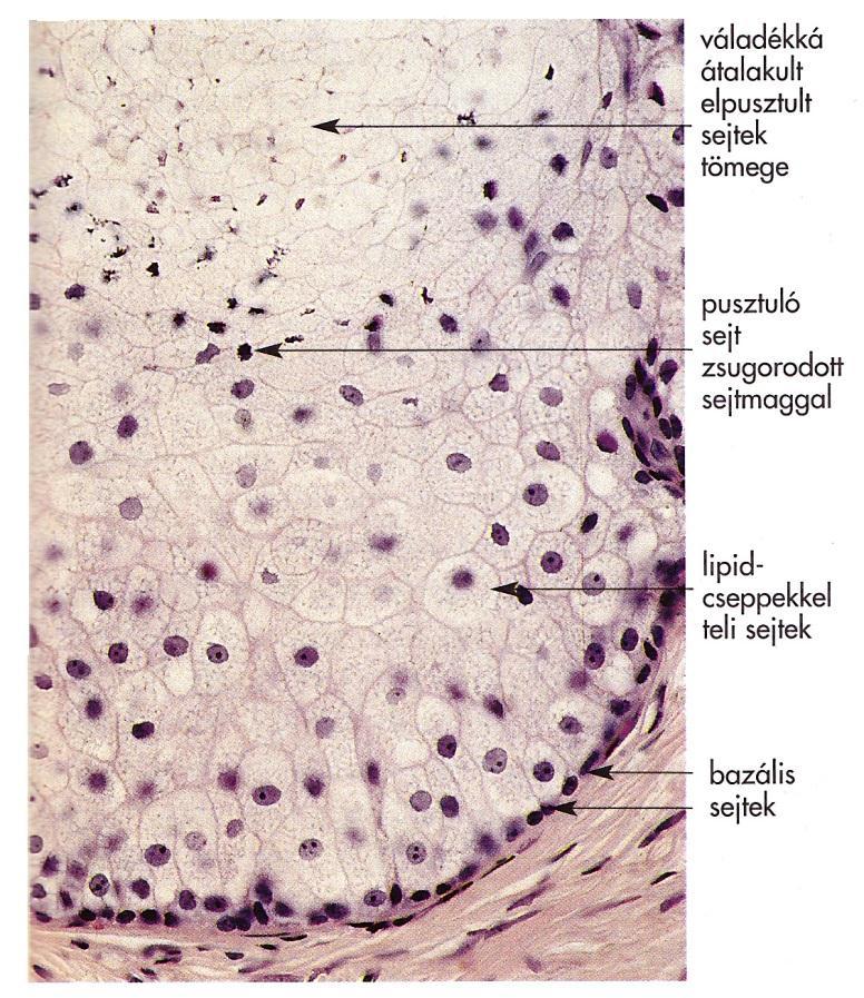 papilláris urothel sejtek szaporodása