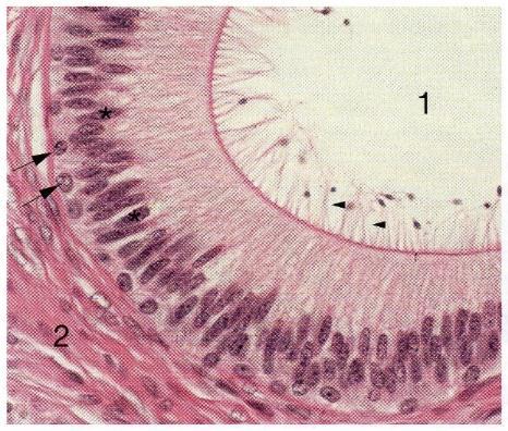 mellékhere csatornái (ductus epididymidis), belső fül szőrsejtek Egyrétegű, ugyanis