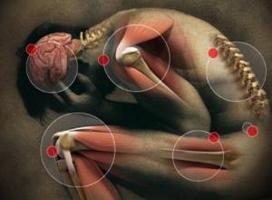A probio=kumok által kiváltoi an=inflamma=kus válasz kedvező hatású lehet a krónikus mozgásszervi betegségekben A TNF-gátlás kedvező hatása jól ismert az RA kezelésében. A L.