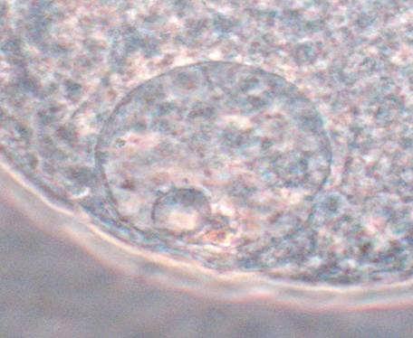 Ezek az adatok azt mutatják, hogy a kumulusz sejtekkel körülvett petesejtek eredményesebben vitrifikálhatók, mert a kumulusz sejtek segítségével könnyebben folytatódik bennük a meiozis folyamata,