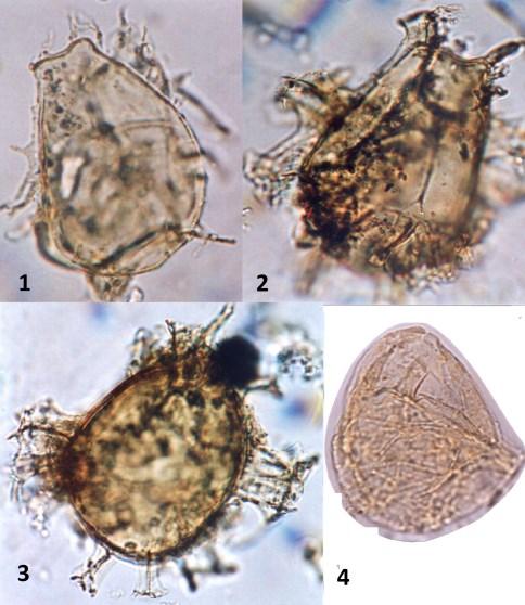 Spiniferites bentorii (Rossignol 1964) körte alakú/piriform, 1. 77,6 77,7 m, 60 μm, 2-3. 75,2 75,3 m 69 μm; 1-3.