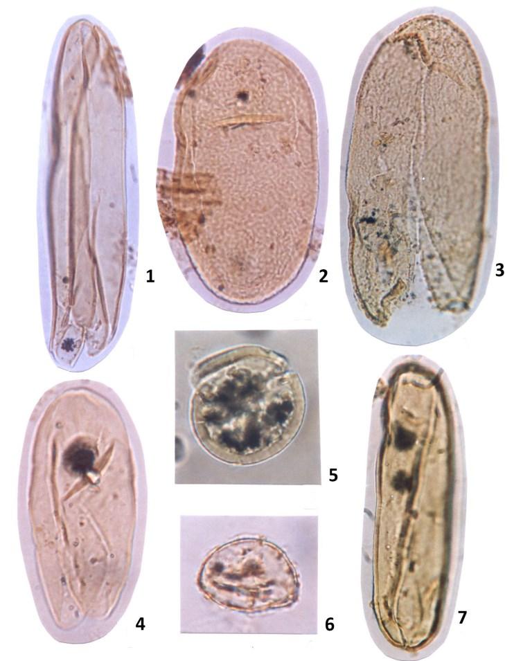 e-acta Naturalia Pannonica 10 (2016) 111 VI. Tábla/Plate VI. 1. 7. Spirogyra longus n. sp. 1. 74,5 74,6 m 130 μm, 7. 77,2 77,3 m 124 μm; 2-4. Spirogyra sp. 2. 74,5 74,6 m 109 μm, 3.