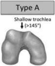 Trochlea dysplasia Dejour beosztás