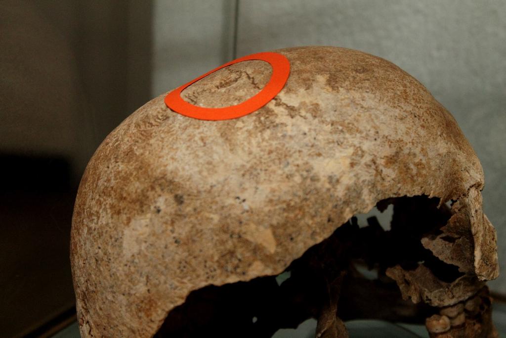 KIÁLLÍTÁSOK / EXHIBITIONS 54 vérmérgezésről, a szemműtétekről, a szülészetről, stb.). A trepanációról c.